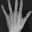 BoneXpert logo
